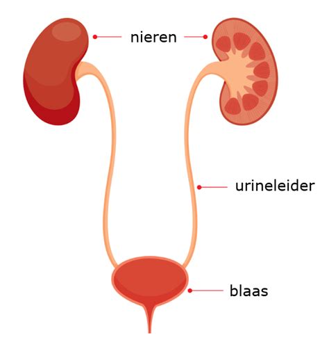 Schematische weergave van een niersteen in de urineleider