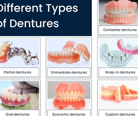 Overzicht van verschillende soorten ovulatietesten en hoe ze werken