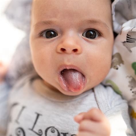 illustratie van een baby met spruw in de mond