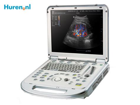 Een afbeelding van een echo-apparaat of een echo-foto van een baby.