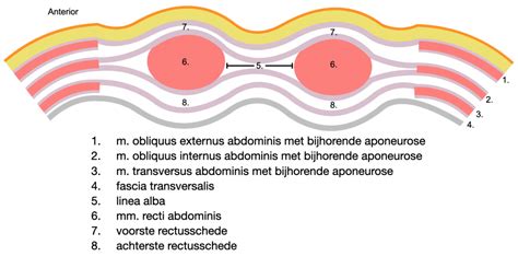 Illustratie van de anatomie van een keizersnede, met de incisies in de buik en baarmoeder.