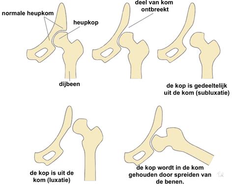 Illustratie die de controle van de heupen bij een pasgeboren baby toont