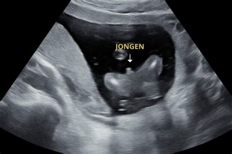 Echo-foto van de baby geplaatst op de zwangere buik
