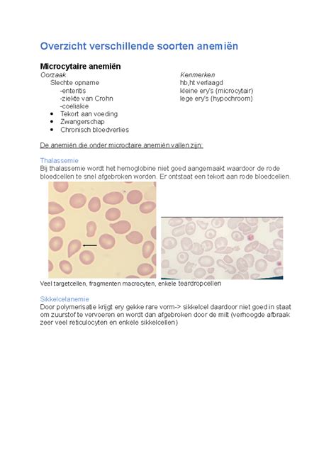Overzicht van verschillende kinderwagenmodellen en hun afmetingen