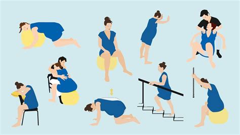 Illustratie van verschillende bevallingshoudingen