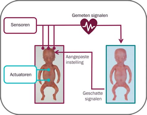 Diagram dat de mogelijke medische problemen bij premature baby's illustreert, zoals longproblemen, geelzucht en voedingsproblemen.