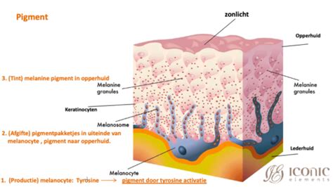 Schematische weergave van hoe zonlicht de aanmaak van melanine in de huidcellen stimuleert, wat leidt tot de vorming van sproeten.