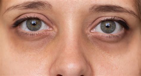 een close-up van een menselijk gelaat, met nadruk op de ogen