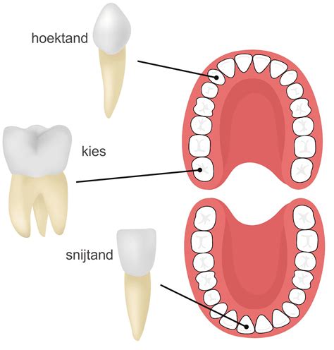 schematische weergave van hoe duimzuigen de tongpositie en de stand van het gebit kan beïnvloeden