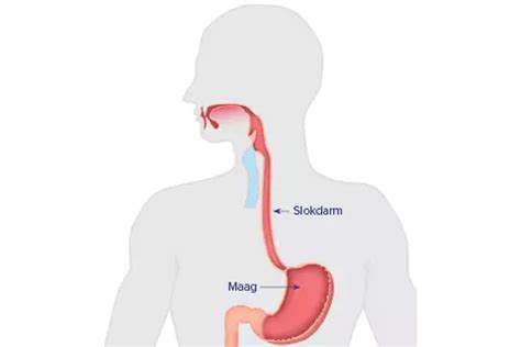 Illustratie van de anatomie van een babymaag en slokdarm, met pijlen die de terugstroming van melk en zuur aangeven.