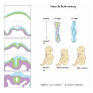 Grafische weergave van de neurale buis ontwikkeling in de vroege zwangerschap.