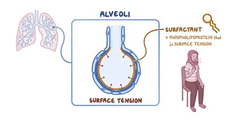 Illustratie van het effect van surfactant op de alveoli
