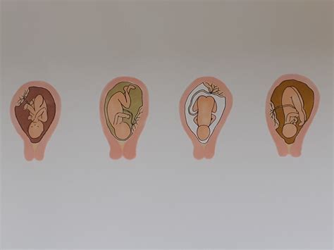 infographic met visuele kenmerken van vruchtwater (helder, roze, groen/bruin)