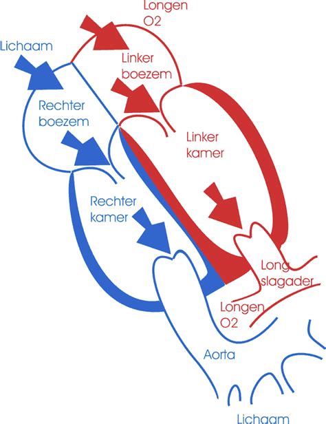Schematische weergave van de verkeerde aansluiting van de grote vaten bij transpositie