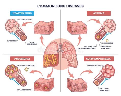 Illustratie van een gezonde klimopmuur met duidelijke snoeiwonden