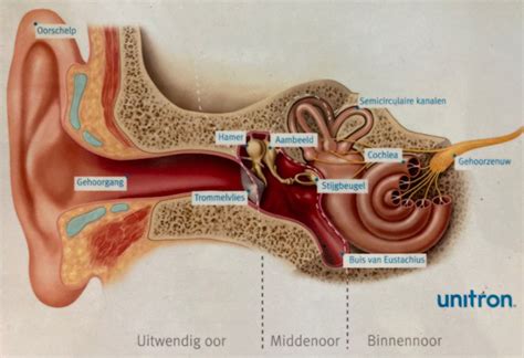 Infographic die de verschillende stappen in het traject van congenitaal gehoorverlies weergeeft.