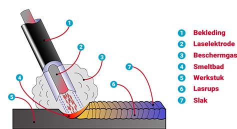 Schema van het BERA-onderzoek met plaatsing van elektroden.