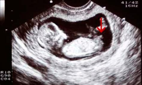 Overzicht van babykledingmaten en hoe deze te bepalen