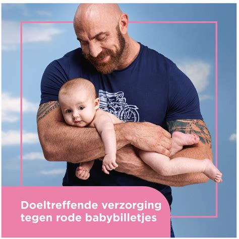 illustratie van babybilletjes met luieruitslag
