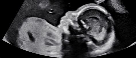 Close-up van een vroege echo met een kloppend hartje.