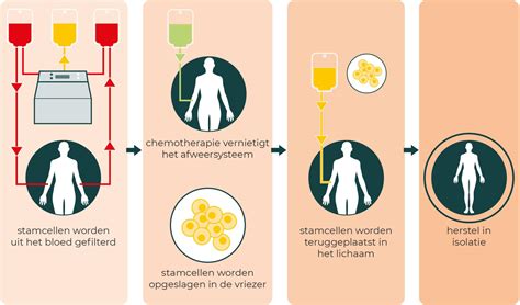 Diagram dat de potentiële effectiviteit van stamceltherapie bij hersenschade bij baby's illustreert.