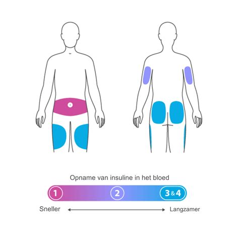 illustratie van een injectie in het bovenbeen of de bil