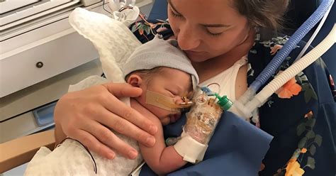 Een pasgeborene in een speciale koelmatras met een koelpakje.