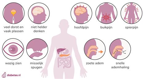 infographic met symptomen van overproductie bij de baby