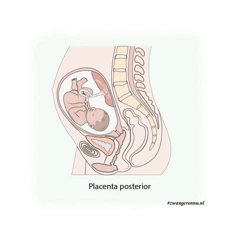 Illustratie van de placenta die zich vasthecht aan de baarmoederwand.