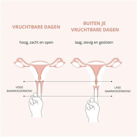 Schematische weergave van de baarmoedermond die opent tijdens de actieve fase.