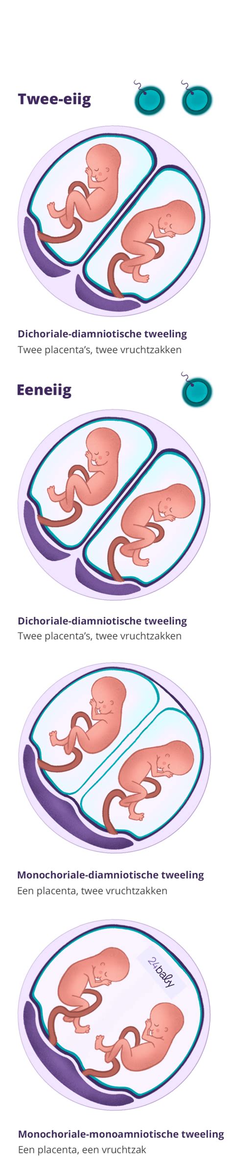 Schematische weergave van de bloedcirculatie bij monochoriale tweelingen en de mogelijke complicaties zoals TTTS en TAPS.