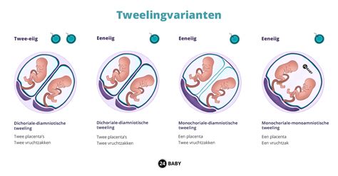 Verschillende typen vruchtzakken en placenta's bij eeneiige tweelingen, met aanduiding van de vroeze, late en zeer late splitsing.