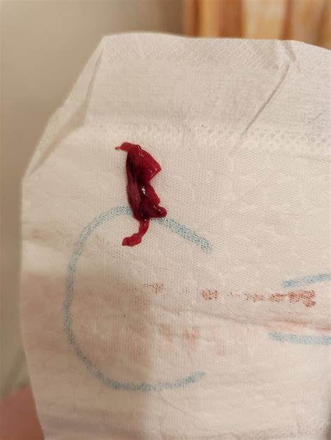 Illustratie die de emotionele impact van een miskraam weergeeft, met symbolen van verdriet, steun en hoop.