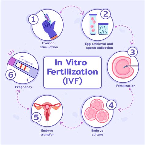 Infographic die de stappen van IVF uitlegt.