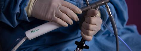 Illustratie van de MyoSure procedure