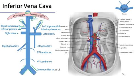 Schematische weergave van de vena cava inferior en de locatie van de baarmoeder tijdens de zwangerschap.