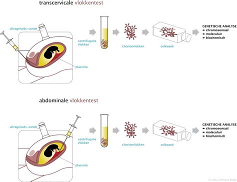 Schematische weergave van de vlokkentest en vruchtwaterpunctie