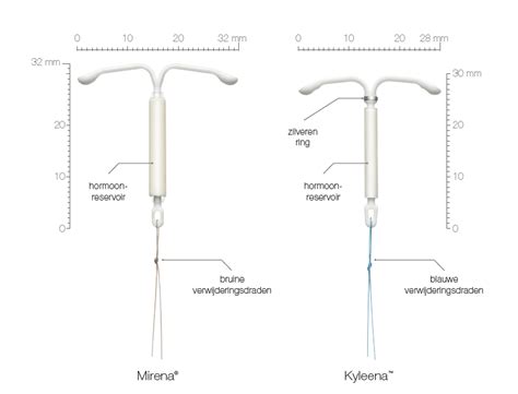 Tabel met een vergelijking van Mirena en Kyleena, inclusief afmetingen, werkingsduur en effect op menstruatie.