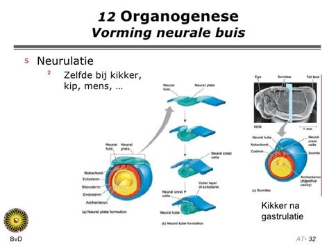 Diagram van de neurale buis en de vorming van de wervelkolom tijdens de embryonale ontwikkeling, met markeringen voor mogelijke sluitingsdefecten die leiden tot spina bifida.