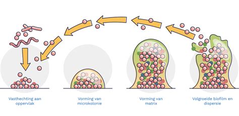 illustratie die de verspreiding van bacteriën van de vagina naar de baarmoeder toont