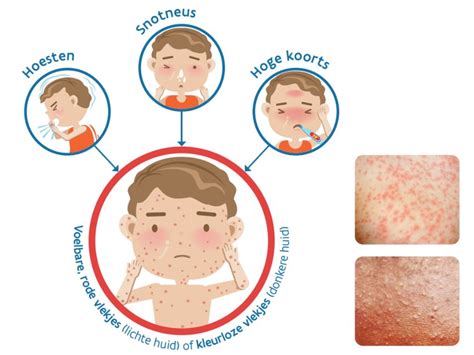 infographic die de mogelijke complicaties van onbehandelde baarmoederinfecties toont