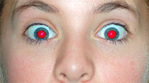 Afbeelding van een kind met rode ogen en symptomen van uitslag