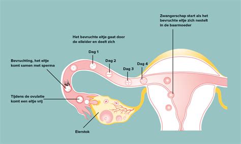 Illustratie die het IVF-proces weergeeft: stimulatie van eierstokken, eicelpunctie, bevruchting in het lab, en embryo-overdracht.