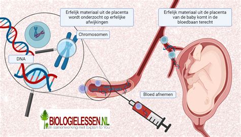 Illustratie die het verschil toont tussen invasieve en niet-invasieve prenatale vaderschapstesten.
