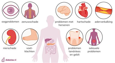 Schema van veelvoorkomende medische aandoeningen bij syndroom van Down.