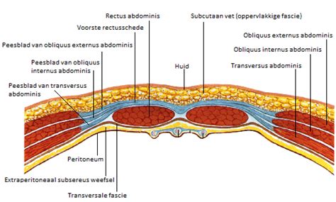 Schema van de anatomie van de buikwand tijdens een keizersnede