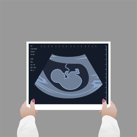 Schematische weergave van een echografie waarop een kloppend hartje van een foetus te zien is.