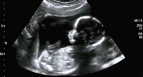 Foto van een echoscopist die een echo maakt van een baby