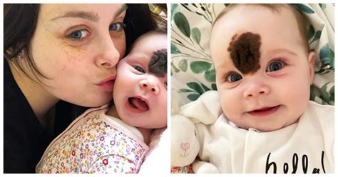 Baby Evie met haar kenmerkende strikje en moedervlek