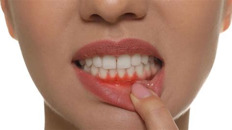 Baby die zachtjes het tandvlees wordt gereinigd met een gaasje